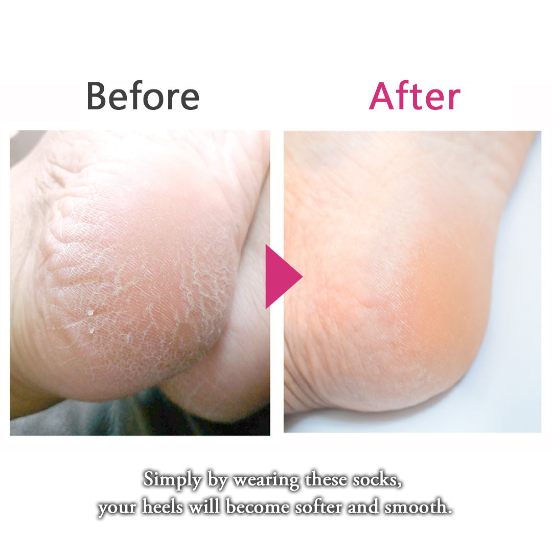 Loose-fitting heel-smoothing socks with elastic cuffs - 649